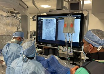 Trombectomía cerebral amplía las opciones de tratamiento en emergencias cerebrovasculares