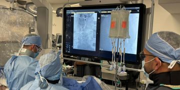 Trombectomía cerebral amplía las opciones de tratamiento en emergencias cerebrovasculares